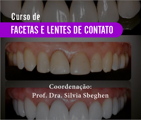 Curso de Facetas e Lentes de Contato